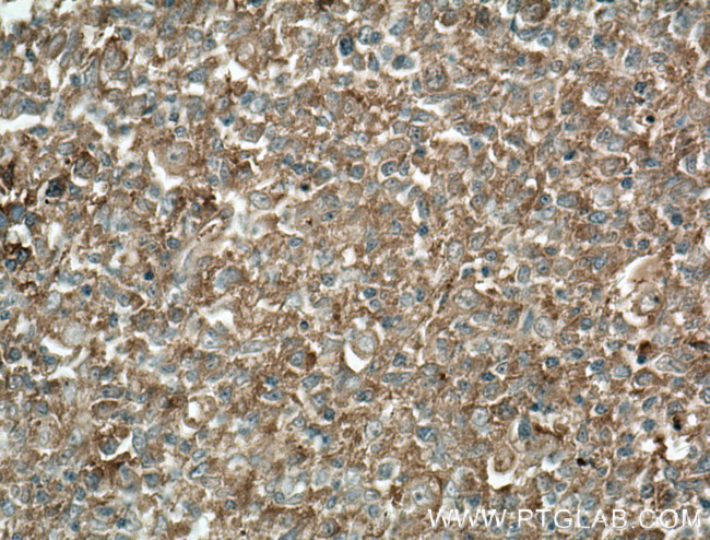 HVCN1 Antibody in Immunohistochemistry (Paraffin) (IHC (P))