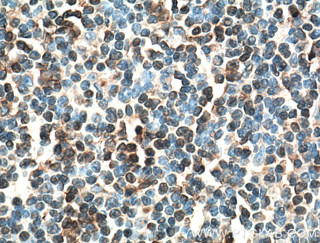 IRF4 Antibody in Immunohistochemistry (Paraffin) (IHC (P))