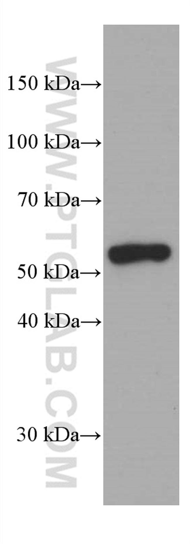 IRF4 Antibody in Western Blot (WB)