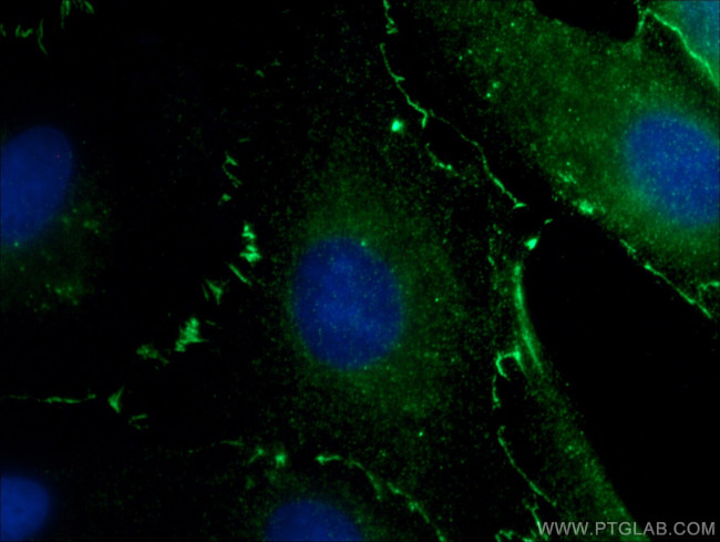 ZO-1 Antibody in Immunocytochemistry (ICC/IF)