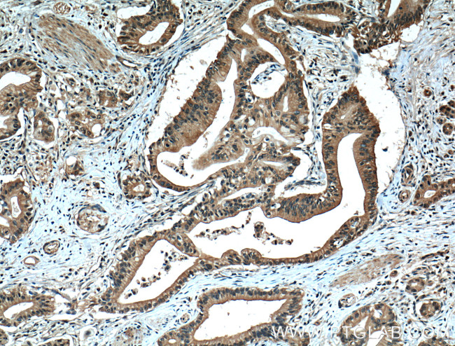 ZO-1 Antibody in Immunohistochemistry (Paraffin) (IHC (P))