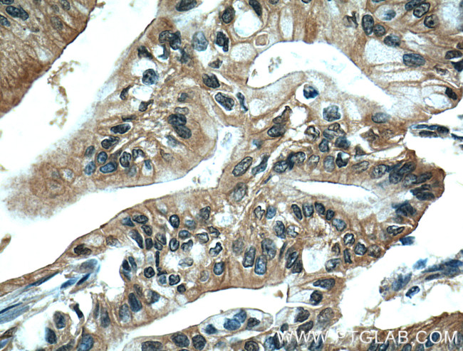 ZO-1 Antibody in Immunohistochemistry (Paraffin) (IHC (P))