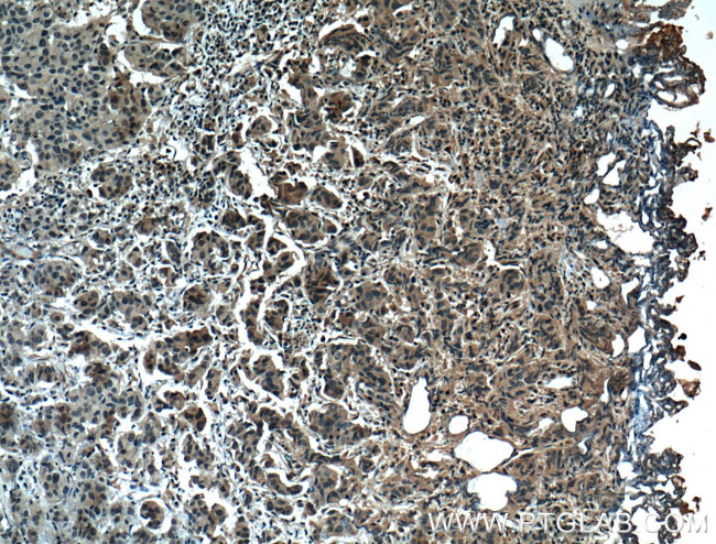 ZO-1 Antibody in Immunohistochemistry (Paraffin) (IHC (P))