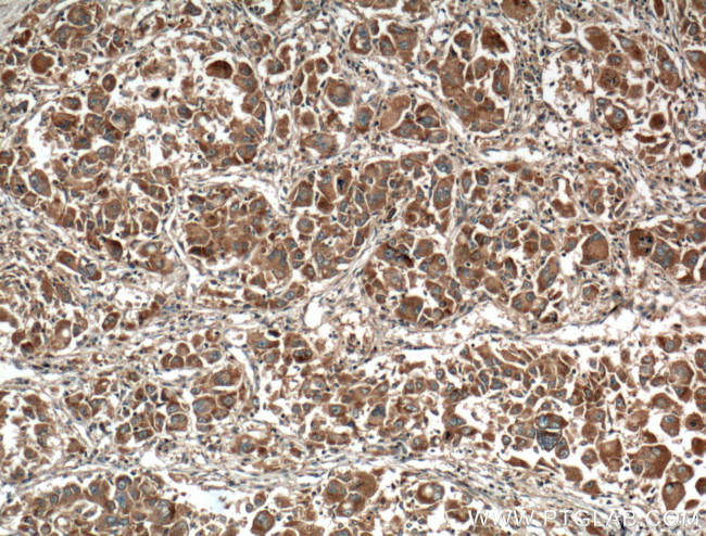 GNPAT Antibody in Immunohistochemistry (Paraffin) (IHC (P))