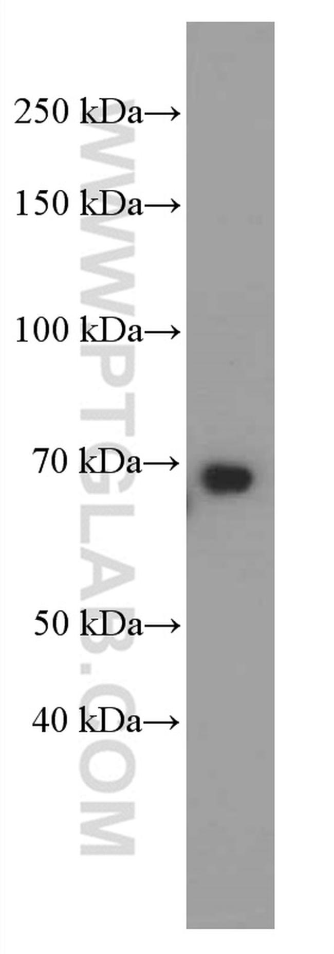 GNPAT Antibody in Western Blot (WB)