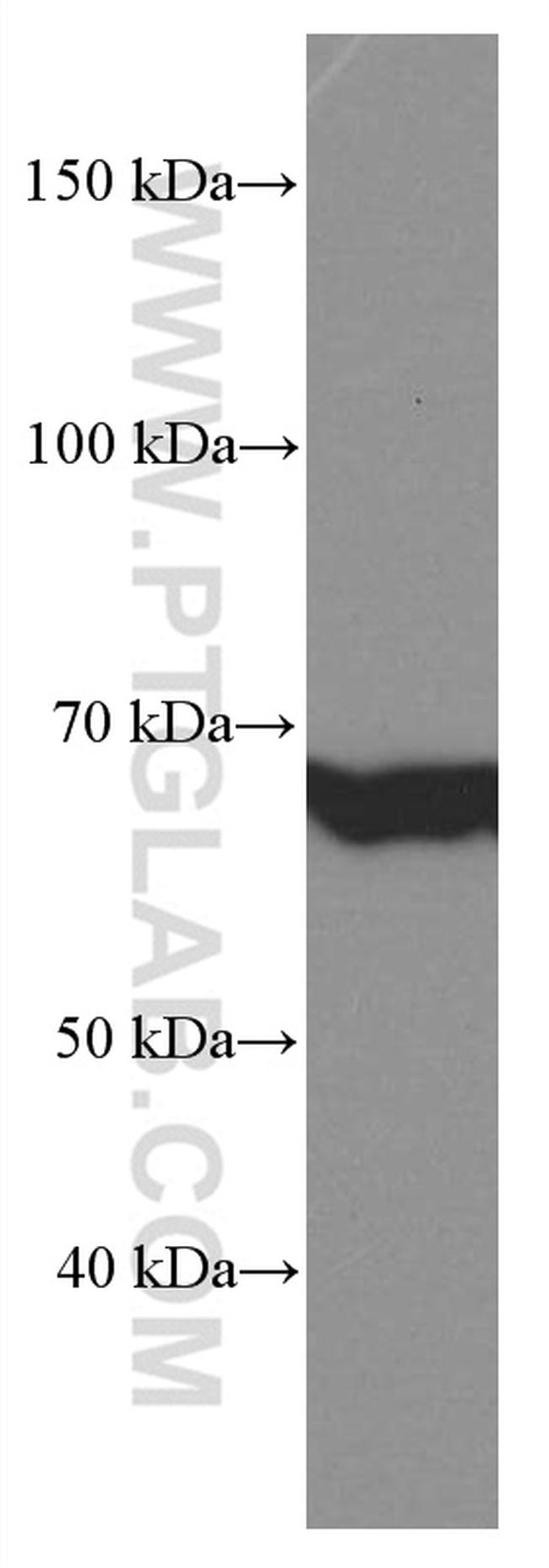 GNPAT Antibody in Western Blot (WB)