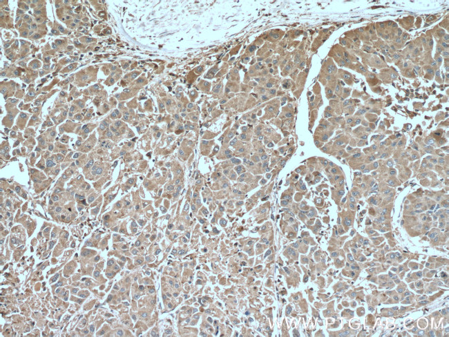 SERPINA7 Antibody in Immunohistochemistry (Paraffin) (IHC (P))