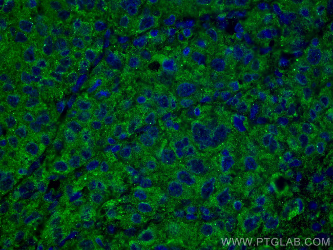 SERPINA7 Antibody in Immunohistochemistry (PFA fixed) (IHC (PFA))