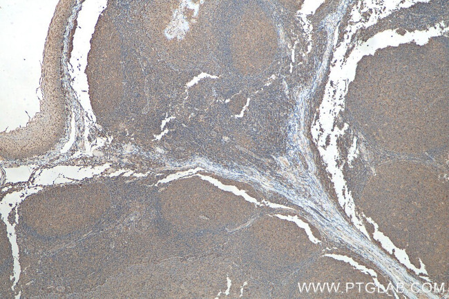 Lysozyme Antibody in Immunohistochemistry (Paraffin) (IHC (P))