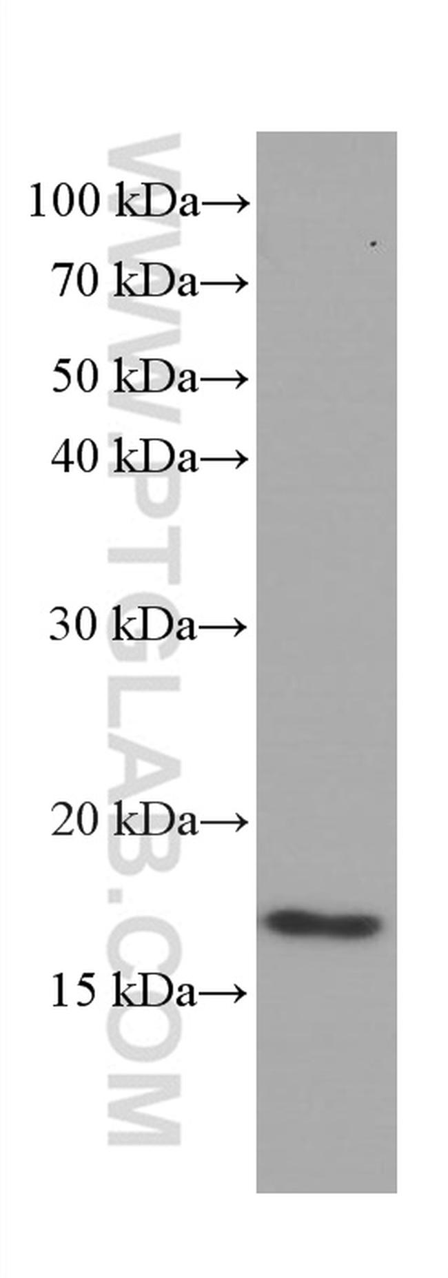 Lysozyme Antibody in Western Blot (WB)