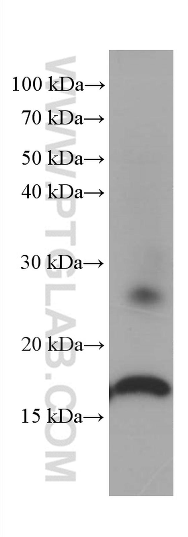 Lysozyme Antibody in Western Blot (WB)