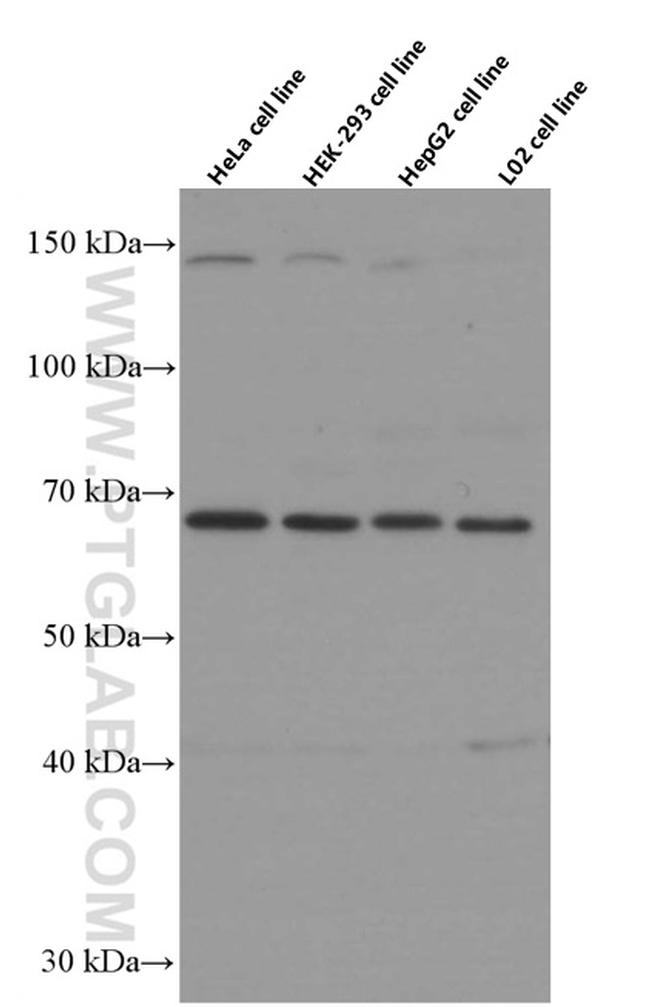 FOXO1 Antibody in Western Blot (WB)