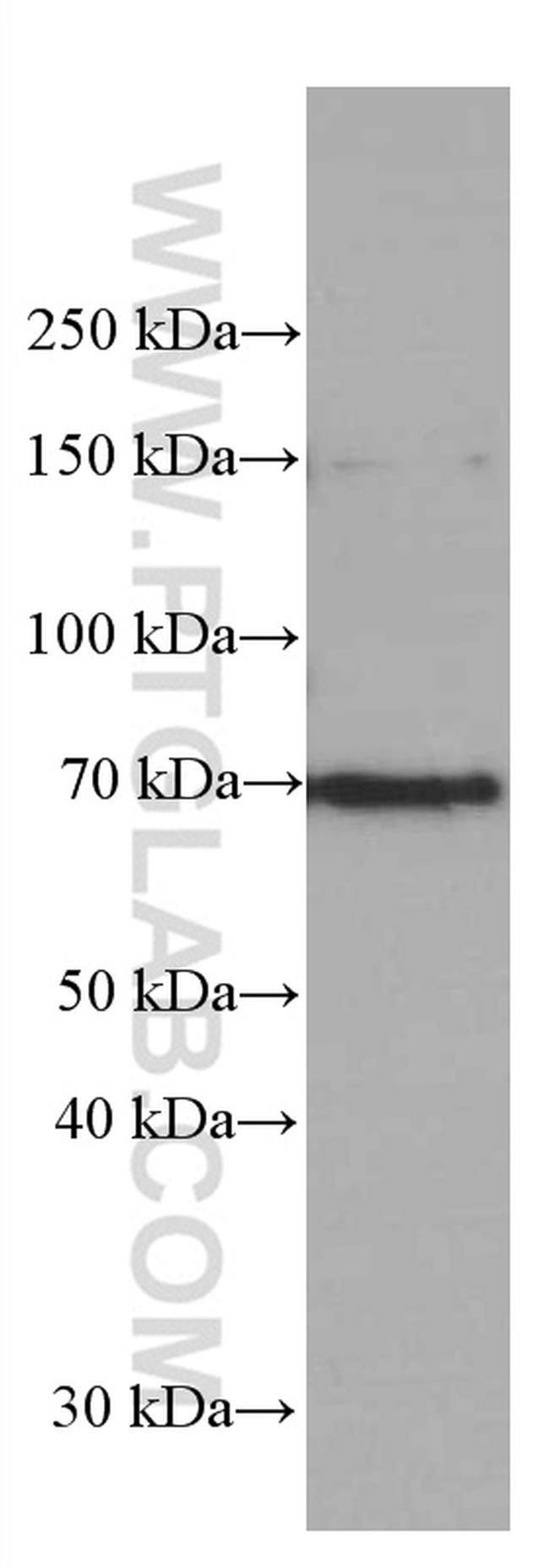 FOXO1 Antibody in Western Blot (WB)