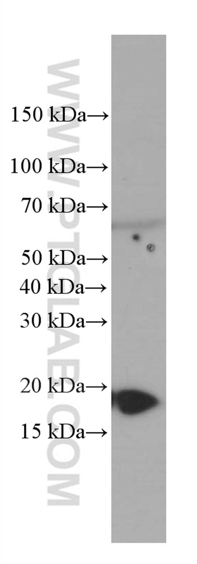 GABARAPL1 Antibody in Western Blot (WB)