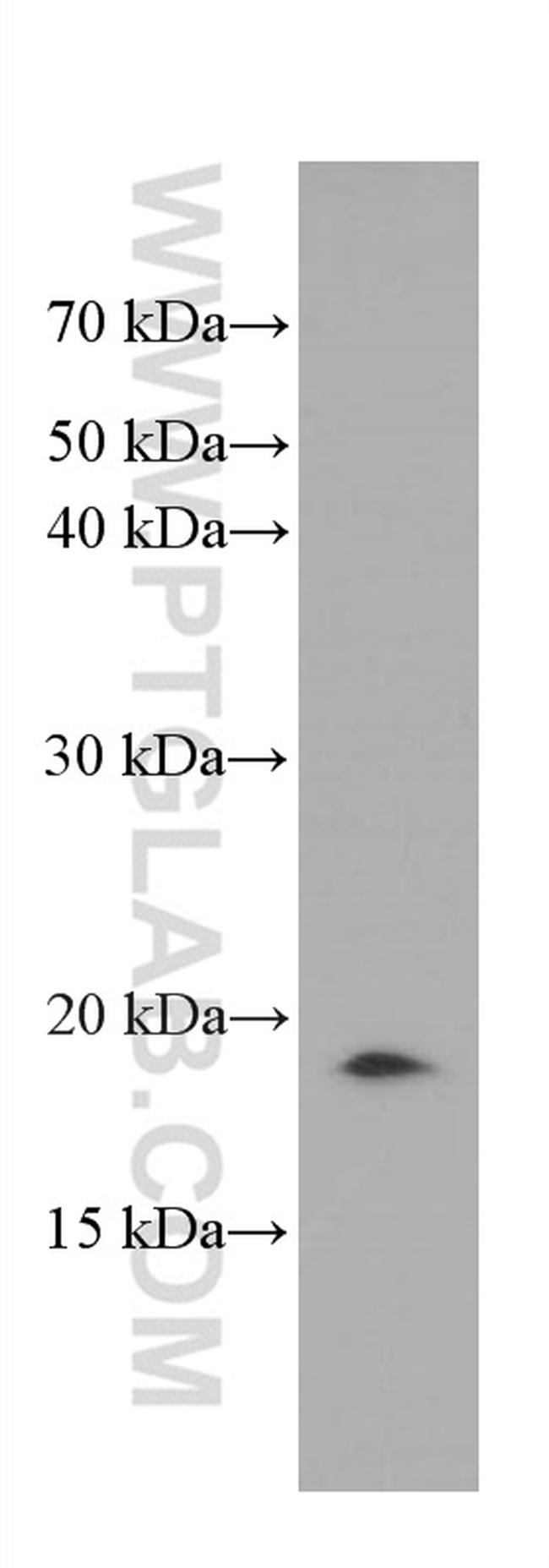 GABARAPL1 Antibody in Western Blot (WB)