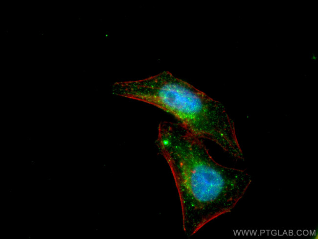 STAT5A Antibody in Immunocytochemistry (ICC/IF)