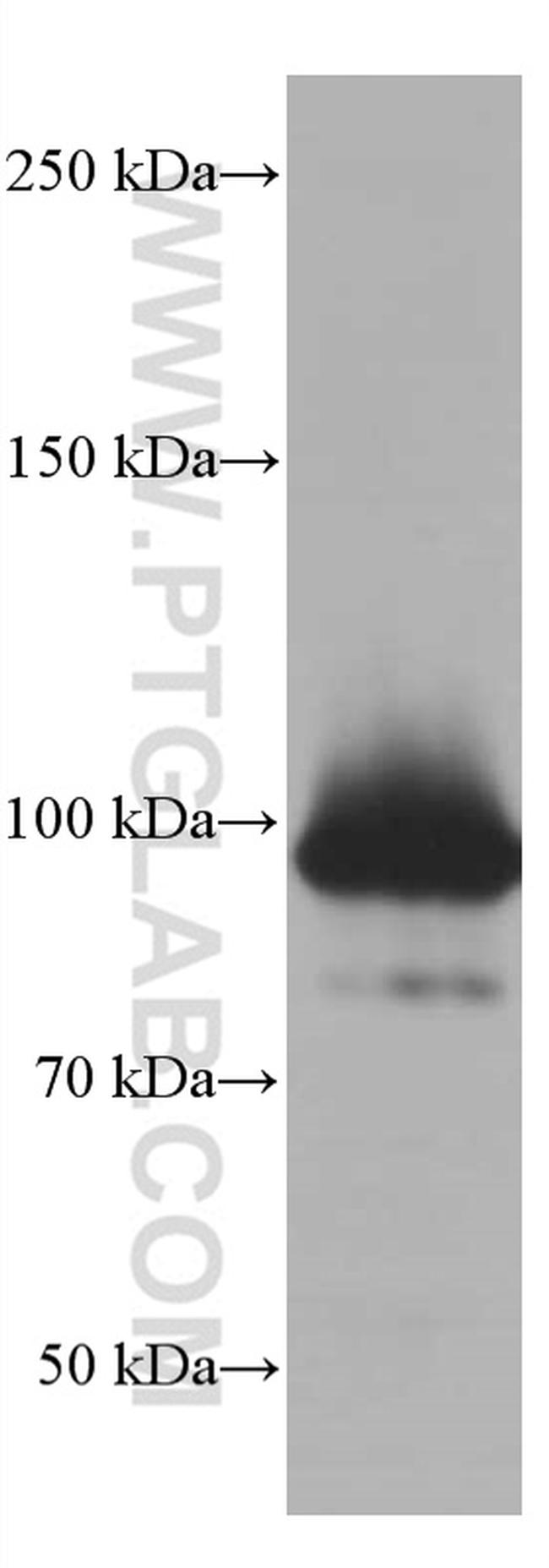 STAT5A Antibody in Western Blot (WB)