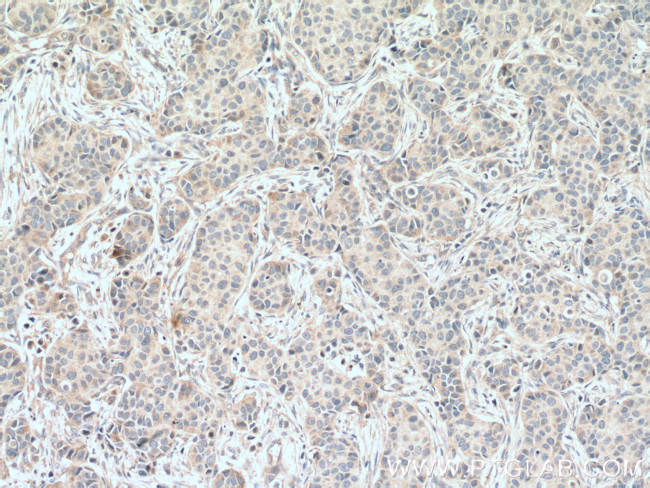 IKBKG Antibody in Immunohistochemistry (Paraffin) (IHC (P))