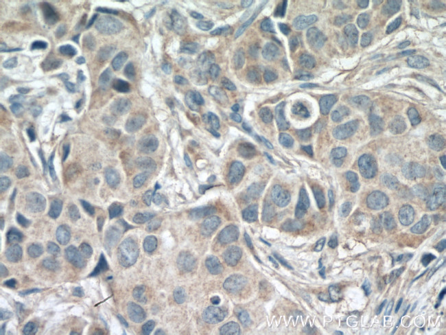 IKBKG Antibody in Immunohistochemistry (Paraffin) (IHC (P))