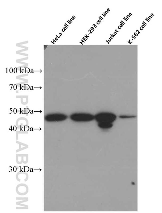 IKBKG Antibody in Western Blot (WB)