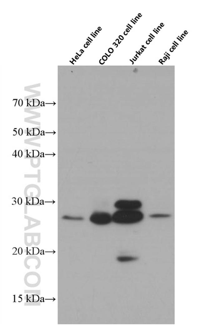 OIP5 Antibody in Western Blot (WB)