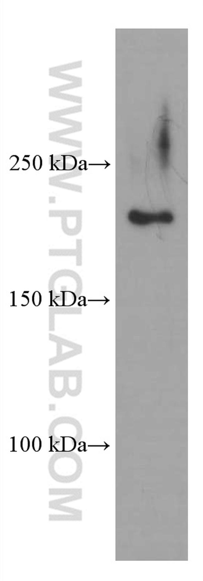 CAMSAP2 Antibody in Western Blot (WB)