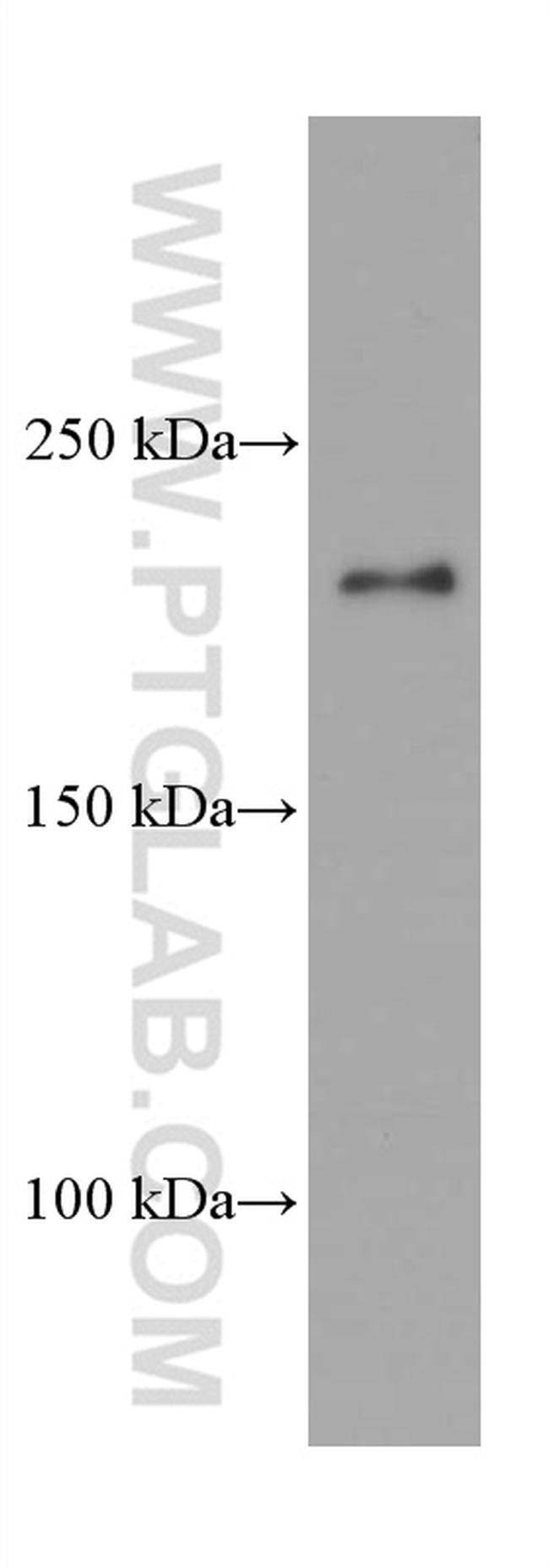 CAMSAP2 Antibody in Western Blot (WB)