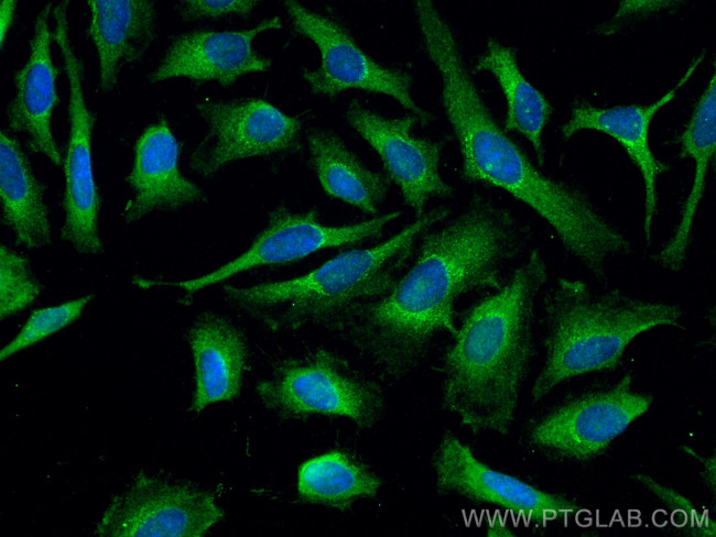 ADRM1 Antibody in Immunocytochemistry (ICC/IF)