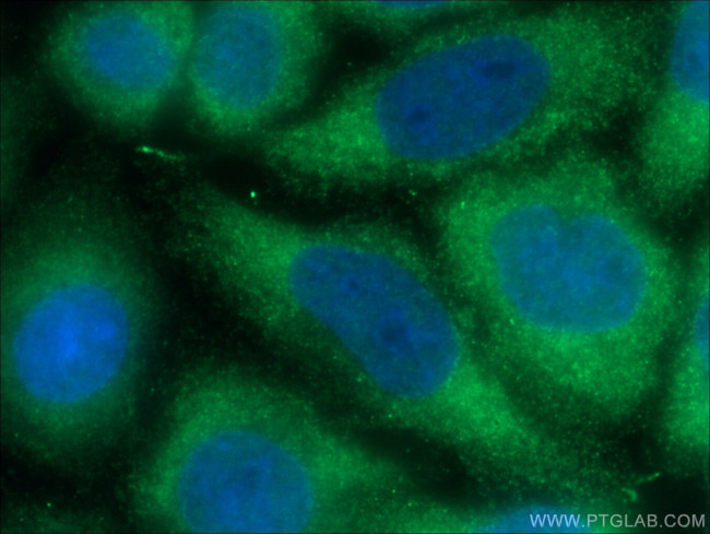 SLP76 Antibody in Immunocytochemistry (ICC/IF)