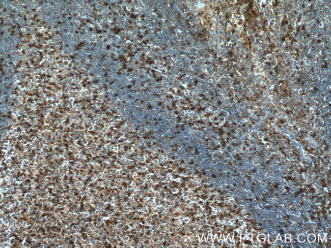 SLP76 Antibody in Immunohistochemistry (Paraffin) (IHC (P))