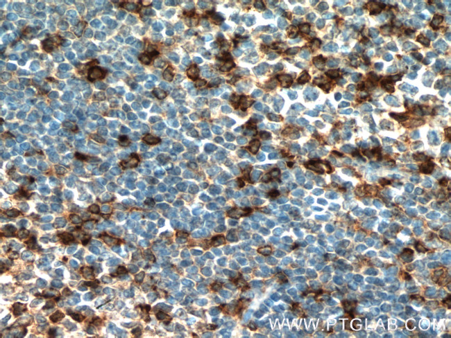 SLP76 Antibody in Immunohistochemistry (Paraffin) (IHC (P))