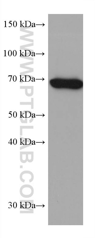 SLP76 Antibody in Western Blot (WB)