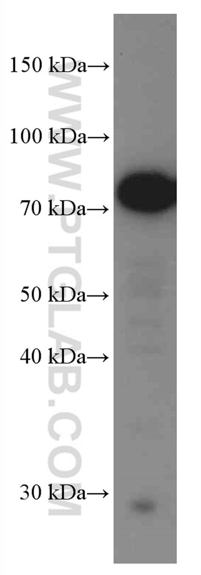 SLP76 Antibody in Western Blot (WB)