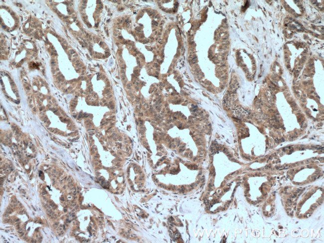 JAK1 Antibody in Immunohistochemistry (Paraffin) (IHC (P))