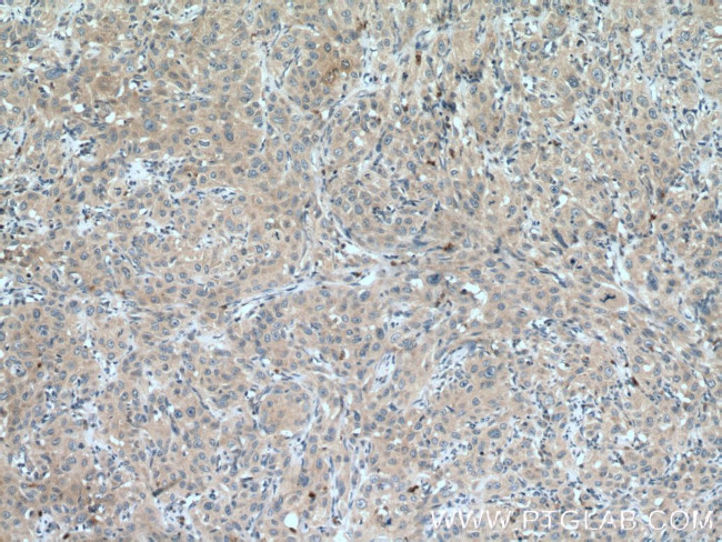 JAK1 Antibody in Immunohistochemistry (Paraffin) (IHC (P))