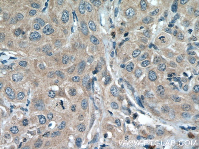 JAK1 Antibody in Immunohistochemistry (Paraffin) (IHC (P))