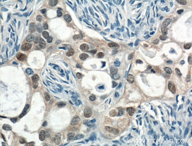 CRABP2 Antibody in Immunohistochemistry (Paraffin) (IHC (P))