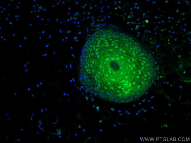 CRABP2 Antibody in Immunohistochemistry (PFA fixed) (IHC (PFA))