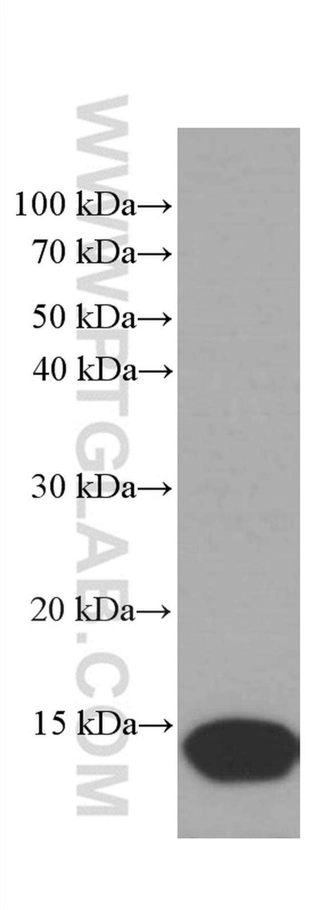 CRABP2 Antibody in Western Blot (WB)