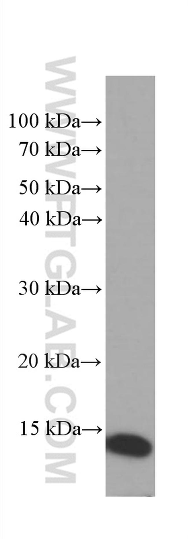 CRABP2 Antibody in Western Blot (WB)