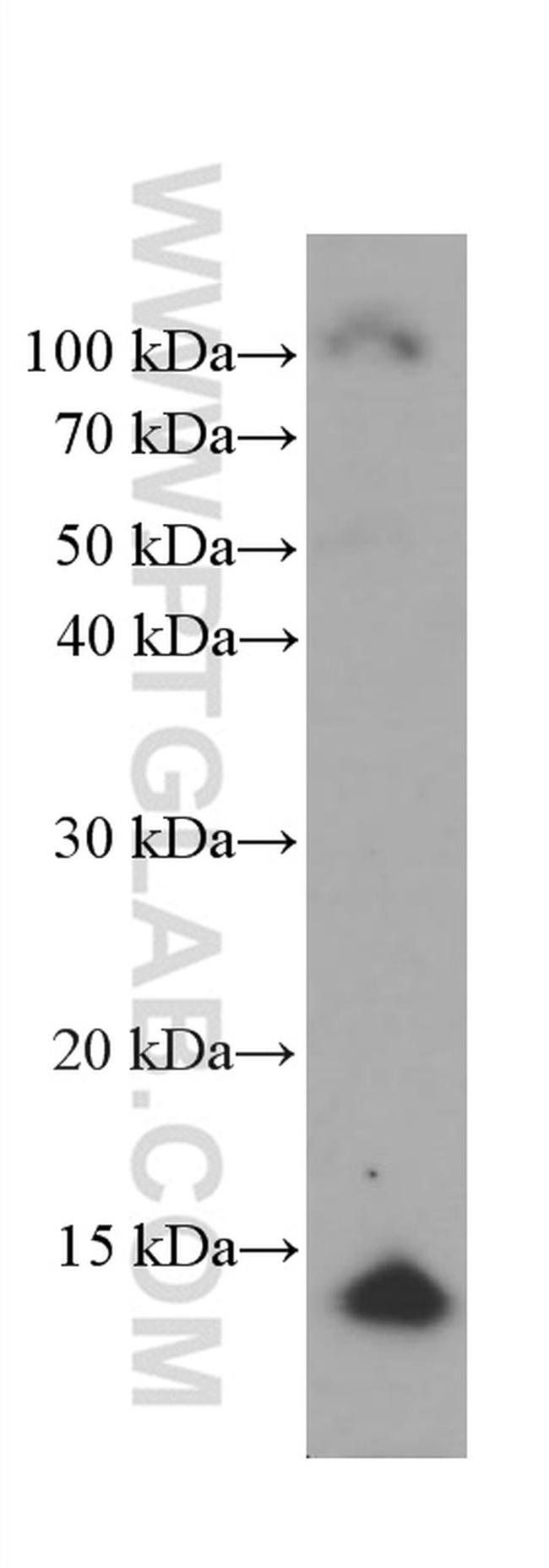 CRABP2 Antibody in Western Blot (WB)