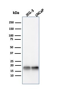 Superoxide Dismutase 1 (SOD1) (Antioxidant Enzyme) Antibody in Western Blot (WB)