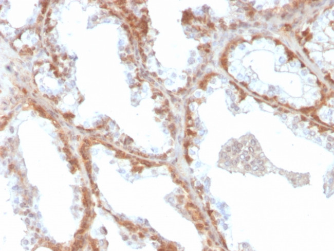 Superoxide Dismutase 1 (SOD1) (Antioxidant Enzyme) Antibody in Immunohistochemistry (Paraffin) (IHC (P))