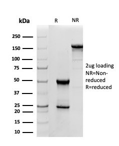 Superoxide Dismutase 1 (SOD1) (Antioxidant Enzyme) Antibody in SDS-PAGE (SDS-PAGE)