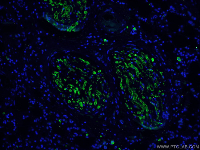 Caspase 3 Antibody in Immunohistochemistry (PFA fixed) (IHC (PFA))