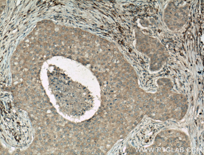 Caspase 3 Antibody in Immunohistochemistry (Paraffin) (IHC (P))