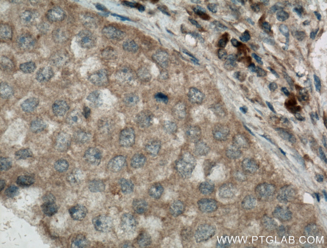 Caspase 3 Antibody in Immunohistochemistry (Paraffin) (IHC (P))