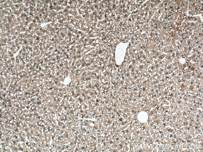 Caspase 3 Antibody in Immunohistochemistry (Paraffin) (IHC (P))