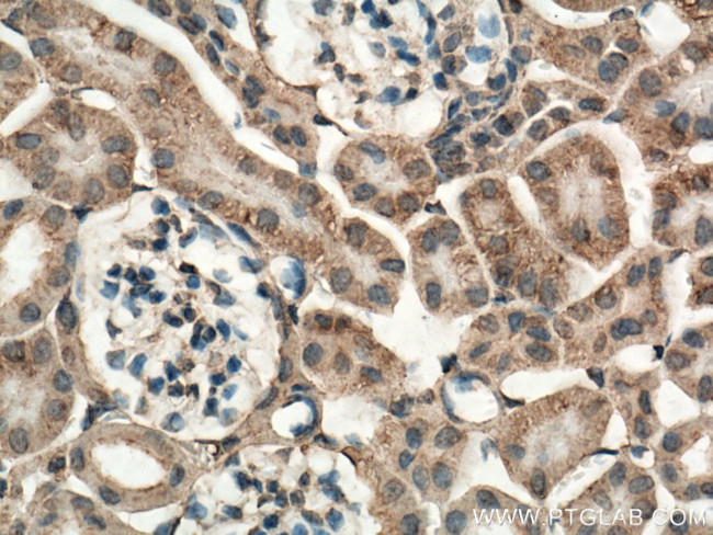 Caspase 3 Antibody in Immunohistochemistry (Paraffin) (IHC (P))