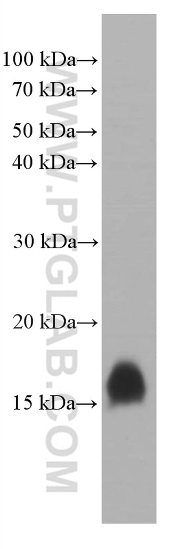 TFF2 Antibody in Western Blot (WB)